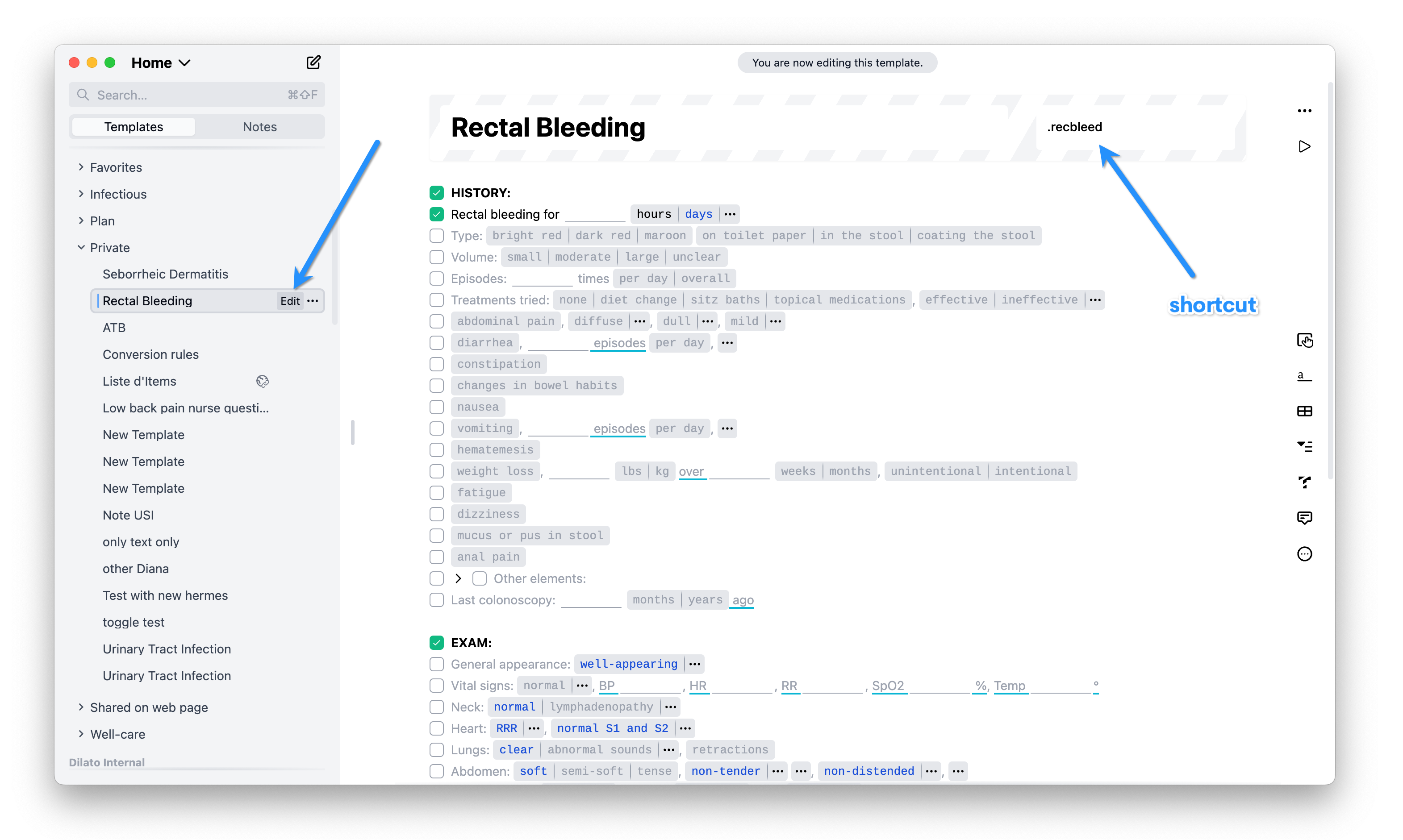 Assigning a shortcut to a template in Dilato